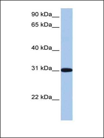 Anti-RFPL2 antibody produced in rabbit