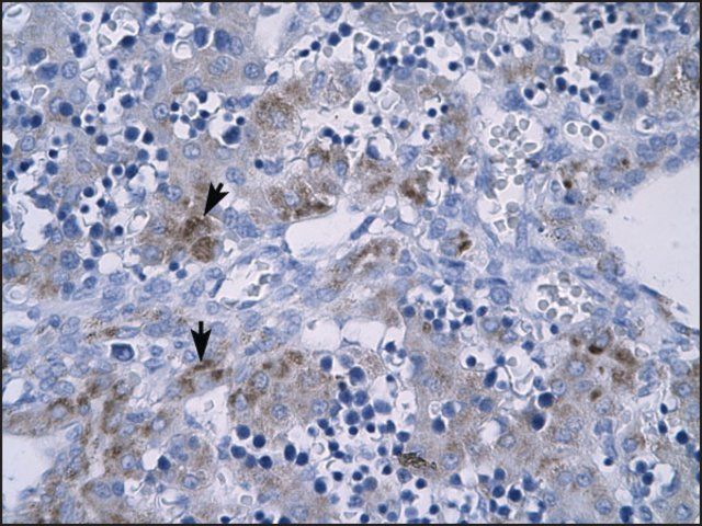 Anti-RGS9 antibody produced in rabbit