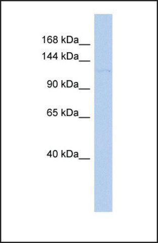 Anti-RIPK5 antibody produced in rabbit