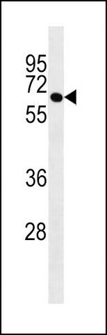 ANTI-ROD1 (N-TERM) antibody produced in rabbit