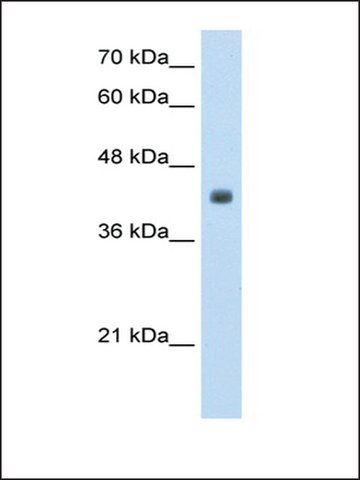 Anti-RP11-82K18.3 antibody produced in rabbit