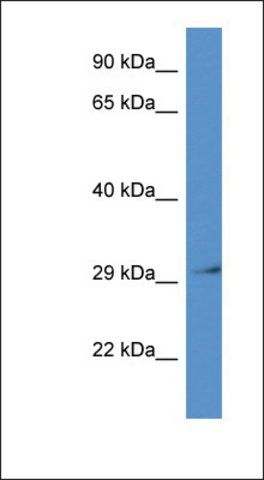 Anti-RPSA antibody produced in rabbit