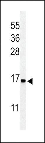 ANTI-RPS25(N-TERMINAL) antibody produced in rabbit