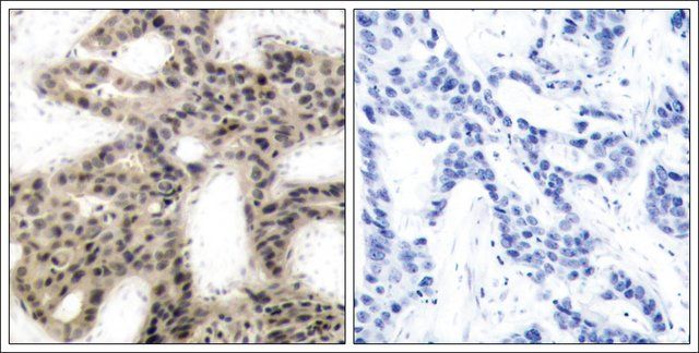 Anti-phospho-EIF4EBP1 (pThr<sup>45</sup>) antibody produced in rabbit