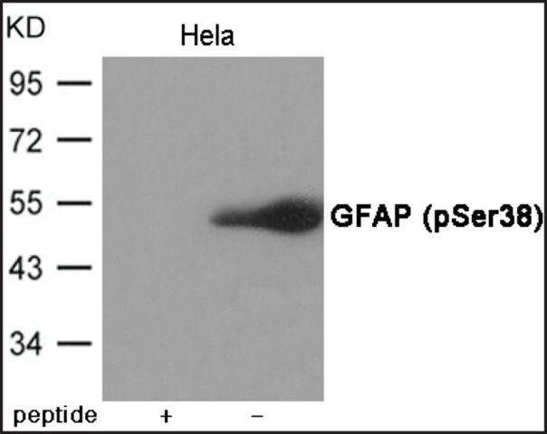 Anti-phospho-GFAP (pSer<sup>38</sup>) antibody produced in rabbit