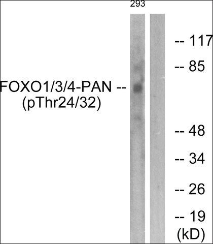 Anti-phospho-FOXO1/3/4-pan (pThr<sup>24/32</sup>) antibody produced in rabbit