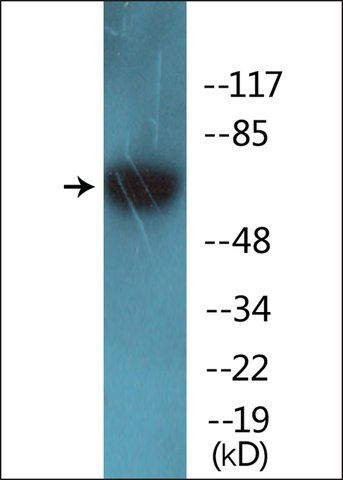 Anti-phospho-GRB10 (pTyr<sup>67</sup>) antibody produced in rabbit