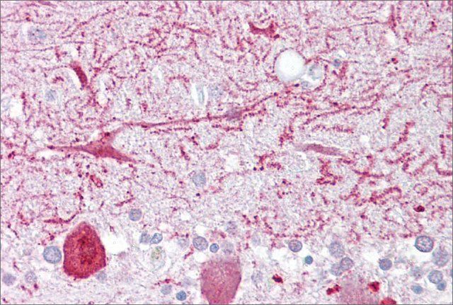 Anti-PON1 antibody produced in rabbit