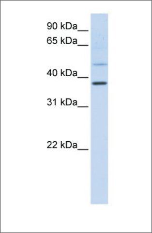 Anti-POU6F1 antibody produced in rabbit