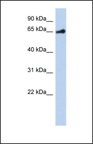 Anti-PPARG, (N-terminal) antibody produced in rabbit