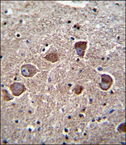 ANTI-PPAPDC1A (N-TERM) antibody produced in rabbit