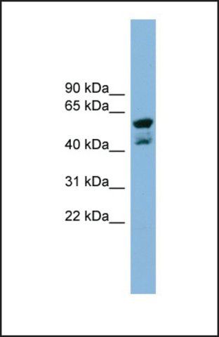 Anti-PPME1, (N-terminal) antibody produced in rabbit