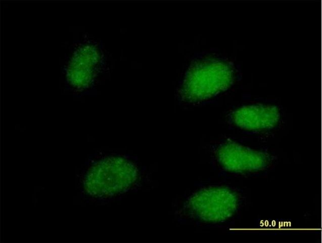 Anti-PPIL4 antibody produced in mouse