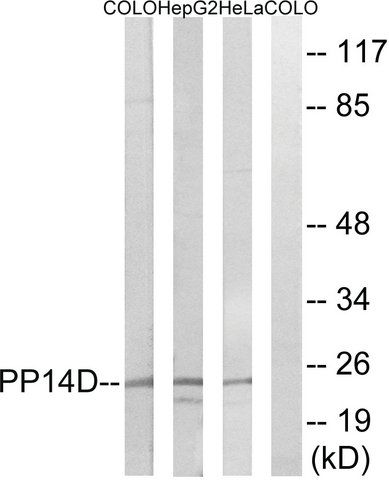 Anti-PPP1R14D antibody produced in rabbit