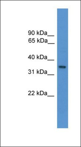 Anti-OR1J1 antibody produced in rabbit