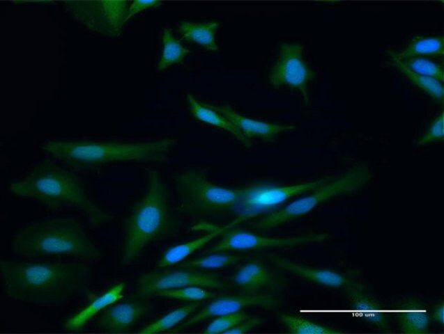 Anti-PADI4 antibody produced in rabbit