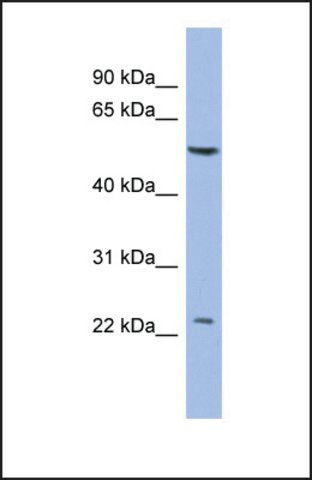 Anti-PABPC1L2A antibody produced in rabbit