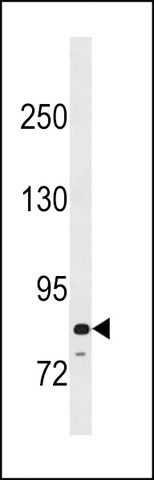 ANTI-PADI6(N-TERMINAL) antibody produced in rabbit