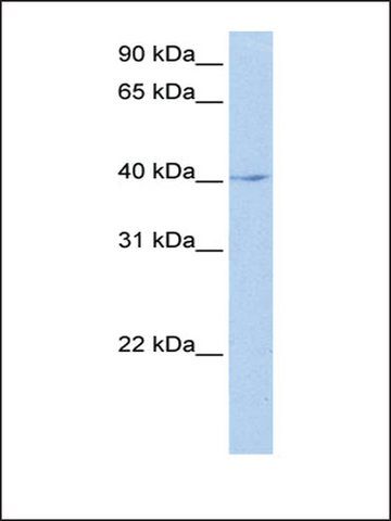 Anti-LOC641765 (AB1) antibody produced in rabbit