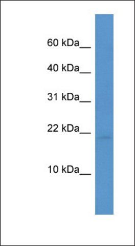 Anti-HSPB7 antibody produced in rabbit