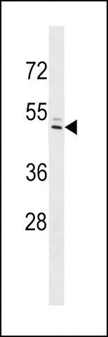 ANTI-IFI44L(C-TERMINAL) antibody produced in rabbit