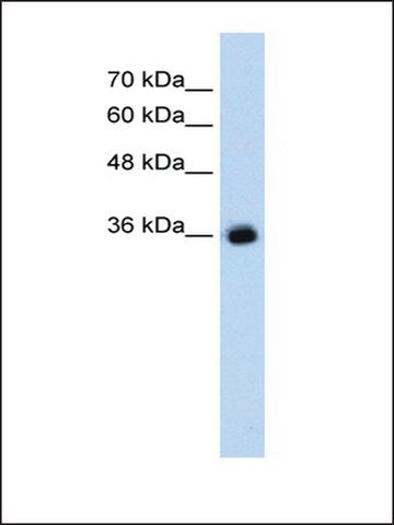 Anti-GABRG2 antibody produced in rabbit