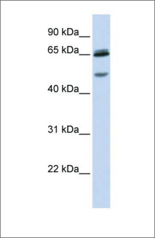 Anti-GABRG2 antibody produced in rabbit