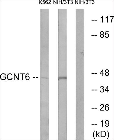 Anti-GCNT6 antibody produced in rabbit