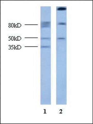 Anti-GCM1 (AB1) antibody produced in rabbit