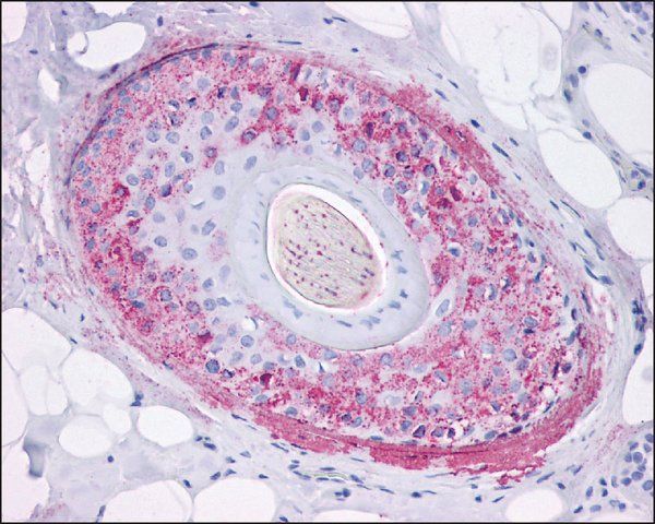 Anti-GHSR antibody produced in rabbit