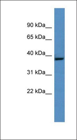 Anti-GHITM antibody produced in rabbit