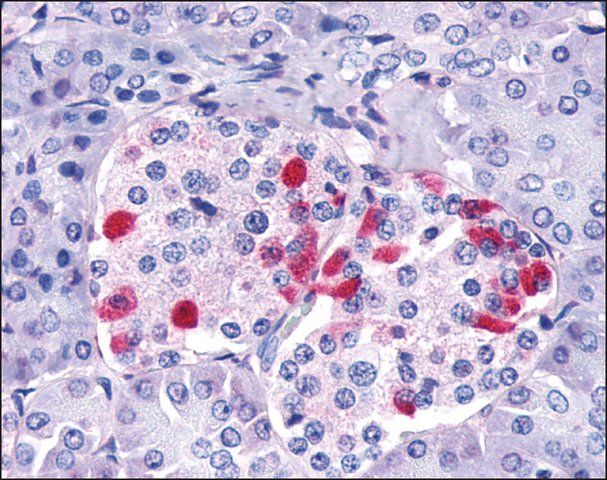 Anti-GIPR antibody produced in rabbit