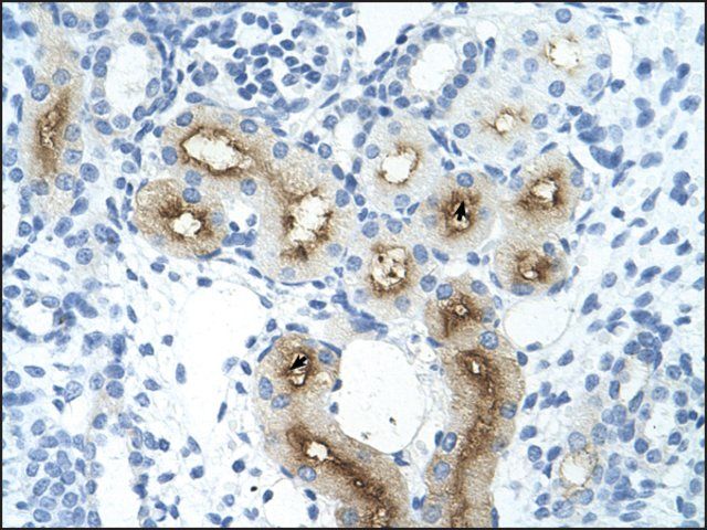 Anti-GGTLA4 antibody produced in rabbit