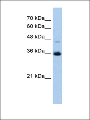 Anti-GGPS1 antibody produced in rabbit