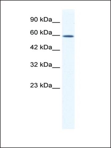 Anti-DDX5 (AB1) antibody produced in rabbit