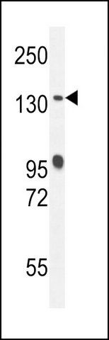 ANTI-DEN5A (CENTER) antibody produced in rabbit