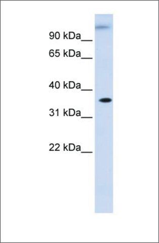 Anti-DHDH antibody produced in rabbit