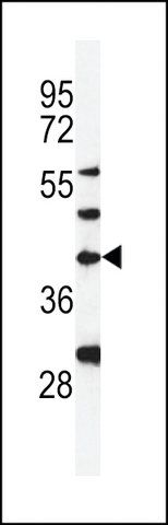 ANTI-DPAGT1 (CENTER) antibody produced in rabbit