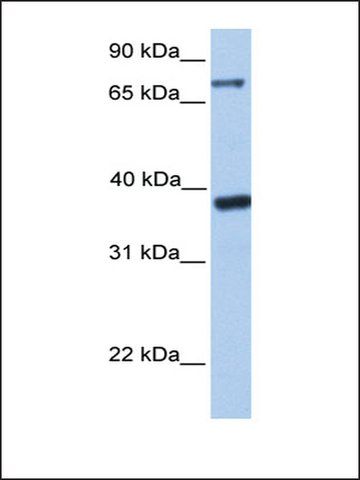 Anti-DIDO1 (AB3) antibody produced in rabbit