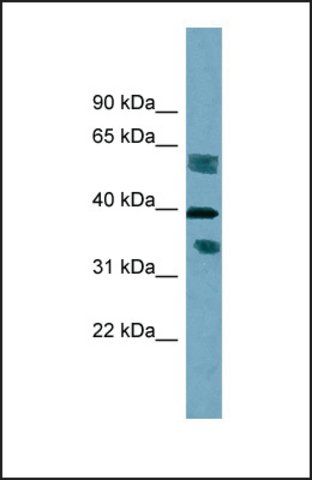 Anti-DHRS7B antibody produced in rabbit