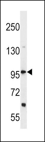 ANTI-DHX36 (CENTER) antibody produced in rabbit