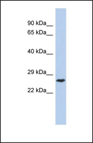 Anti-DIRAS1 antibody produced in rabbit