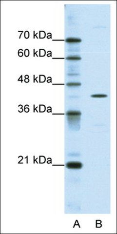 Anti-DOK2 antibody produced in rabbit