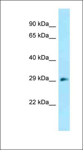 Anti-DNAJC27 antibody produced in rabbit