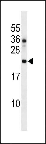 ANTI-DNAJC24 (CENTER) antibody produced in rabbit