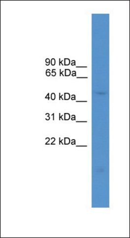 Anti-ELK1P1 antibody produced in rabbit