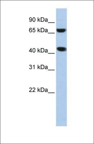 Anti-ELAC1 (ab2) antibody produced in rabbit