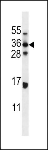 ANTI-ELOVL5(C-TERMINAL) antibody produced in rabbit