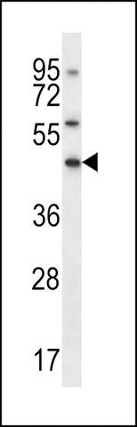 ANTI-ELAVL3(N-TERMINAL) antibody produced in rabbit