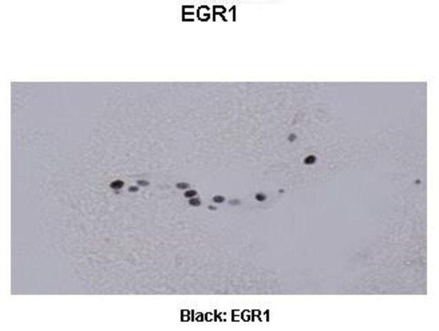 Anti-EGR1, (C-terminal) antibody produced in rabbit